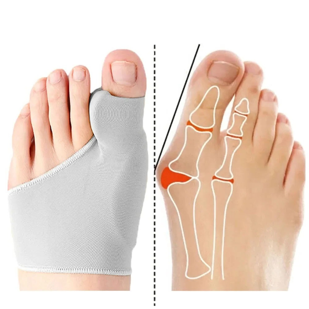 1/2 Paar Teen Separator Hallux - Ankle Brace Sock recensie en prijs