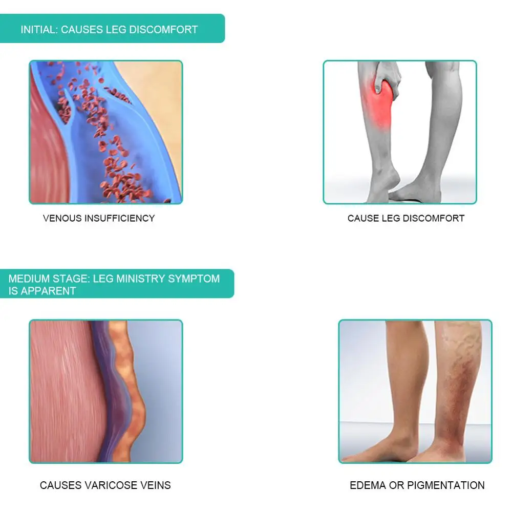 1 Paar Medische Compressie Sok - Compression Sock Medical recensie en prijs