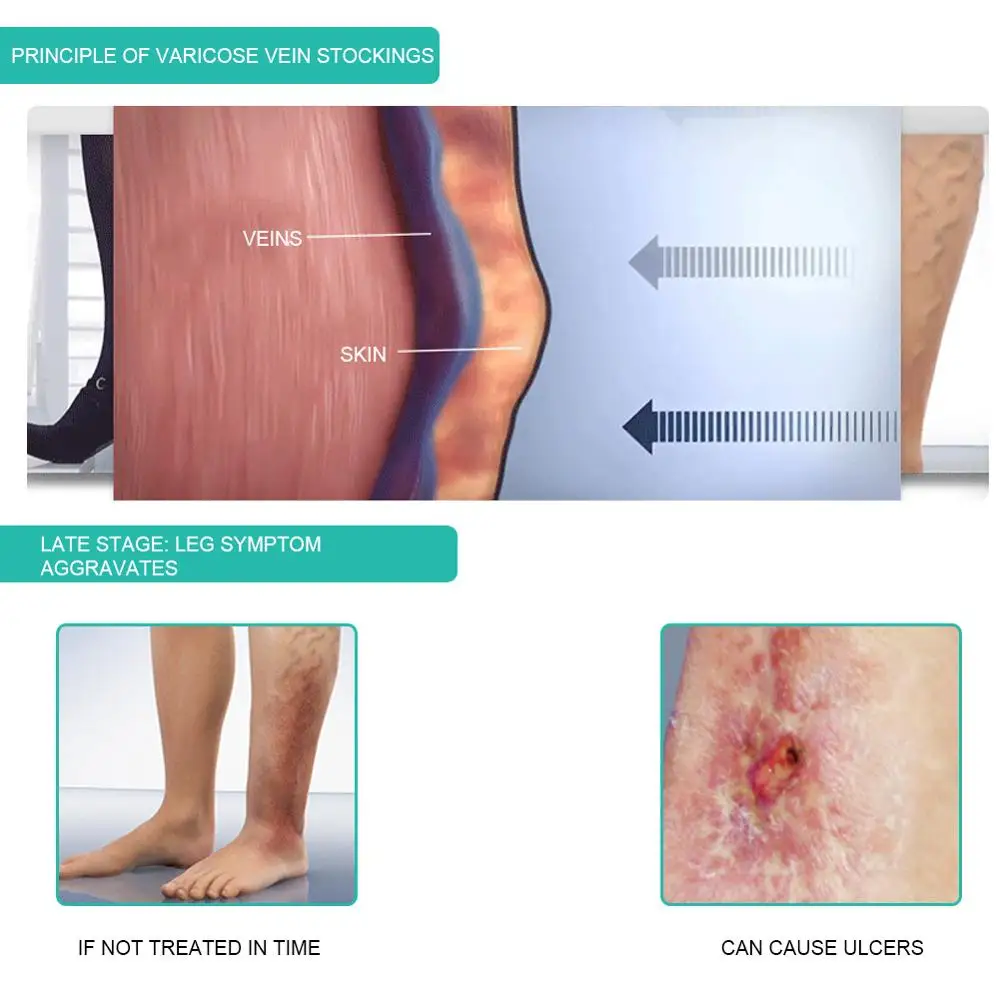 1 Paar Medische Compressie Sok - Compression Sock Medical recensie en prijs